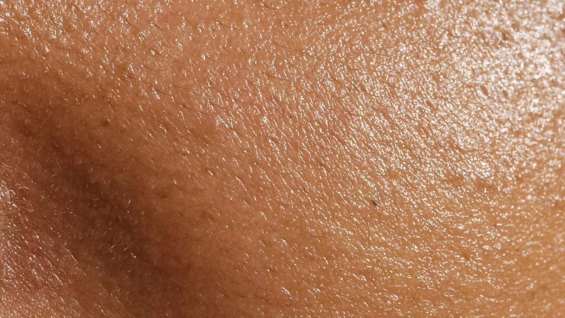 open blocked pores
