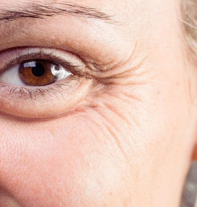 Extraordinary tips to reduce Eye wrinkles!