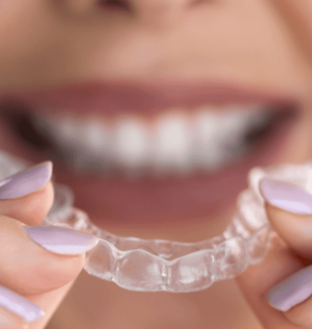 Unexpected Facts About Clear Aligners You Should Be Aware Of!