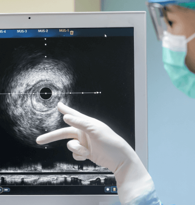 Discover the Shocking Truths of Cardiac Catheterization!