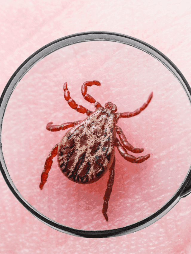 Facts About Tick-Borne Lyme Disease You Need to Know!