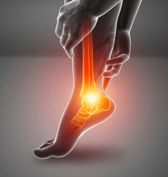 Necrotizing Fasciitis: 10 Critical Facts You Need to Know!